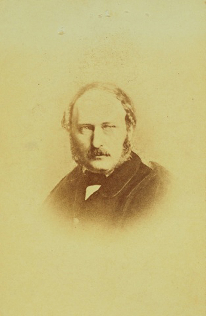 prince albert strabismus